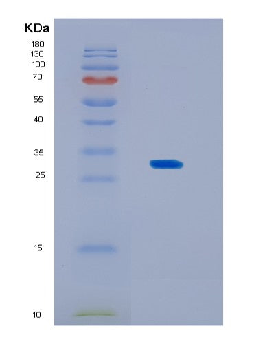 Human KCTD15 (Btb/Poz Domain-Containing Protein Kctd15) - Recombinant Protein