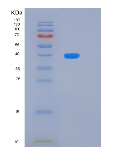 Human KLHDC8B (Kelch Domain-Containing Protein 8B) - Recombinant Protein