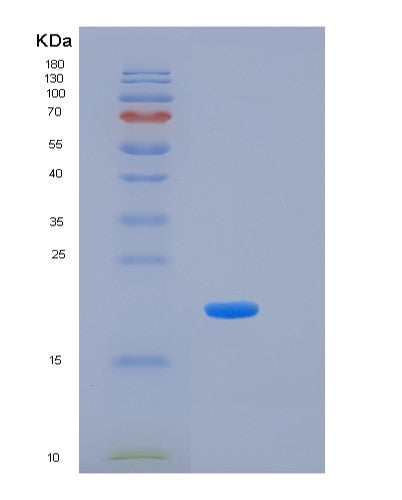 Human KLK7 (Kallikrein-7) - Recombinant Protein