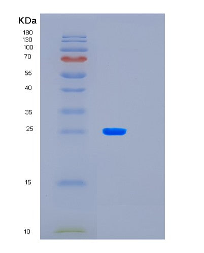 Human LAYN (Layilin) - Recombinant Protein