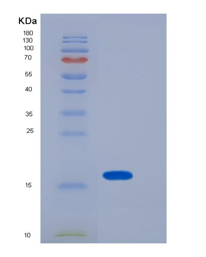 Mouse Lgals1 (Galectin-1) - Recombinant Protein