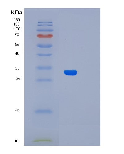 Human LIN7A (Protein Lin-7 Homolog A) - Recombinant Protein