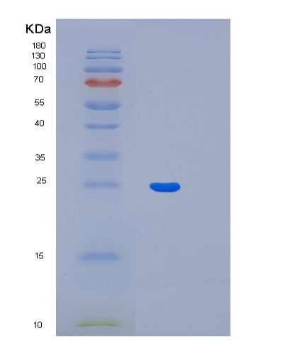 Human LIN7B (Protein Lin-7 Homolog B) - Recombinant Protein
