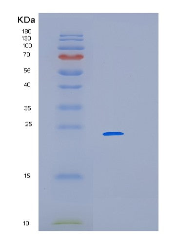 Human LIN7C (Protein Lin-7 Homolog C) - Recombinant Protein