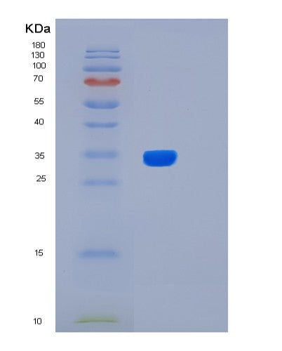 Human BIRC7 (Baculoviral Iap Repeat-Containing Protein 7) - Recombinant Protein
