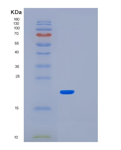 Human LMO1 (Rhombotin-1) - Recombinant Protein