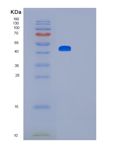 Human LMX1B (Lim Homeobox Transcription Factor 1-Beta) - Recombinant Protein