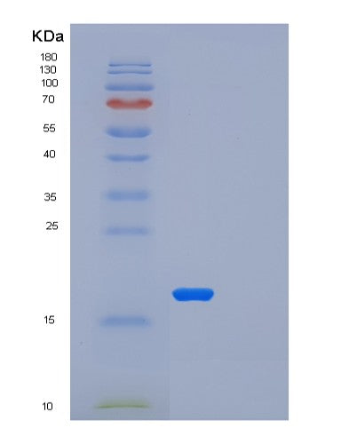 Human LSM1 (U6 Snrna-Associated Sm-Like Protein Lsm1) - Recombinant Protein
