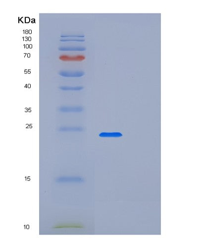 Human LSM12 (Protein Lsm12) - Recombinant Protein