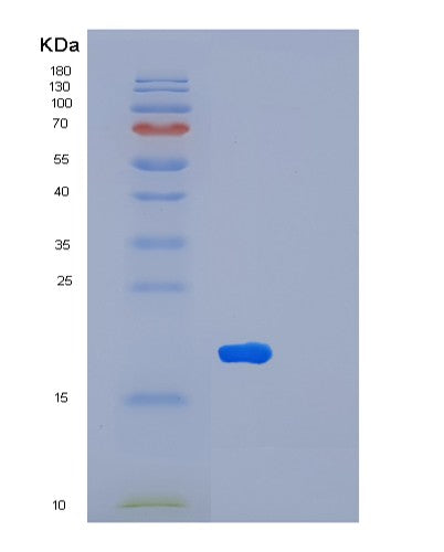 Human LTA (Lymphotoxin-Alpha) - Recombinant Protein