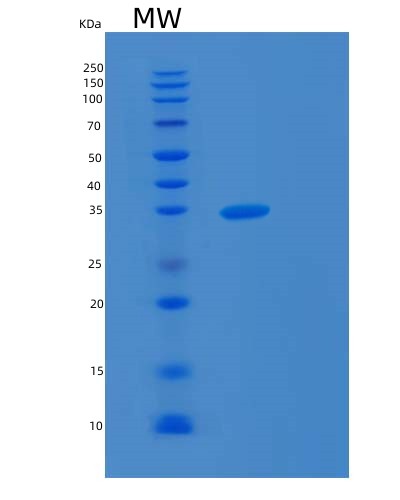 Human MAPRE3 (Microtubule-Associated Protein Rp/Eb Family Member 3) - Recombinant Protein