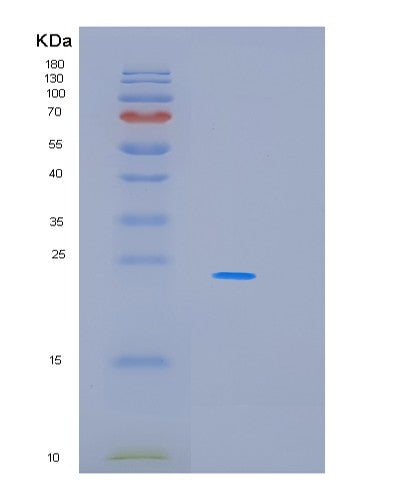 Human MBP (Myelin Basic Protein) - Recombinant Protein