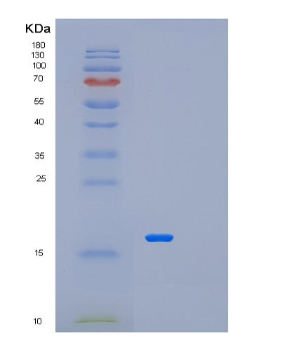Human METTL21A (Protein N-Lysine Methyltransferase Mettl21A) - Recombinant Protein