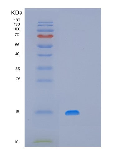 Human MRPS28 (Small Ribosomal Subunit Protein Bs1M) - Recombinant Protein