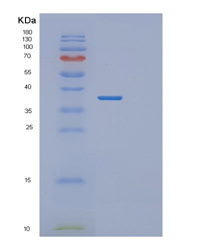 Human MSI2 (Rna-Binding Protein Musashi Homolog 2) - Recombinant Protein