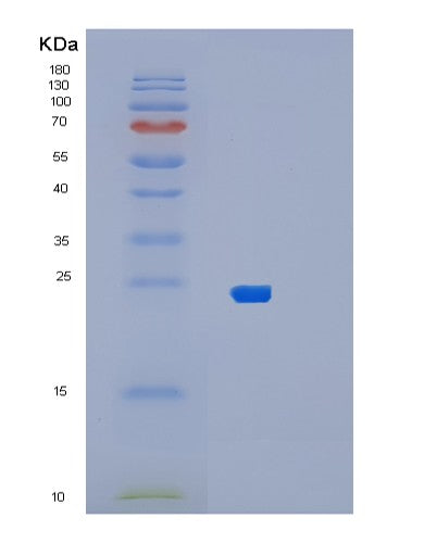 Human BLOC1S5 (Biogenesis Of Lysosome-Related Organelles Complex 1 Subunit 5) - Recombinant Protein