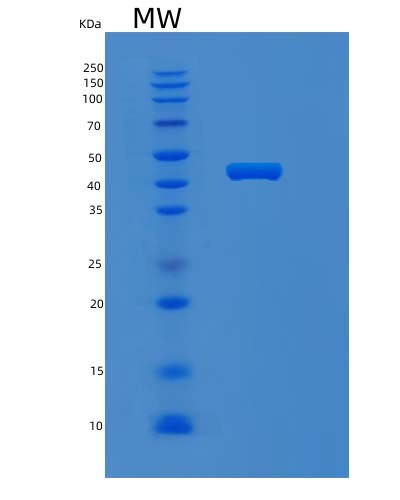 Human MVK (Mevalonate Kinase) - Recombinant Protein