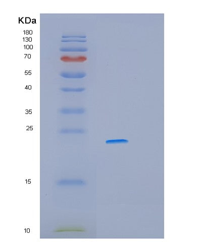 Human MYL11 (Myosin Regulatory Light Chain 11) - Recombinant Protein