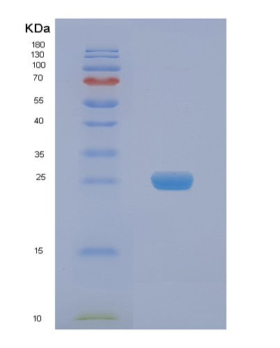 Human NAA50 (N-Alpha-Acetyltransferase 50) - Recombinant Protein