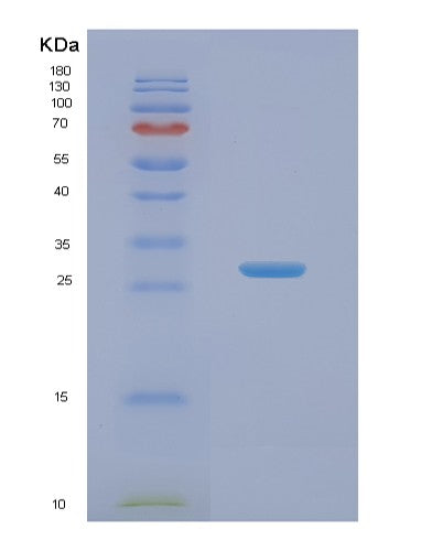 Human NABP1 (Soss Complex Subunit B2) - Recombinant Protein