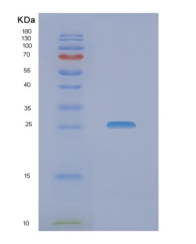 Human NACA (Nascent Polypeptide-Associated Complex Subunit Alpha) - Recombinant Protein