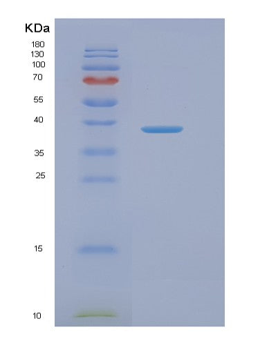 Human NAGK (N-Acetyl-D-Glucosamine Kinase) - Recombinant Protein
