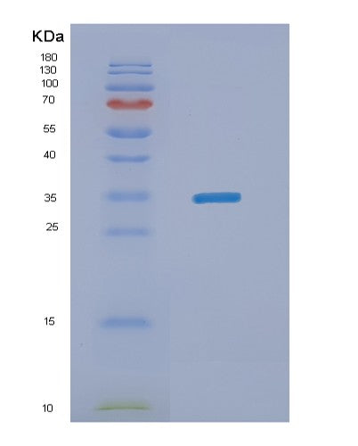 Human NANOG (Homeobox Protein Nanog) - Recombinant Protein
