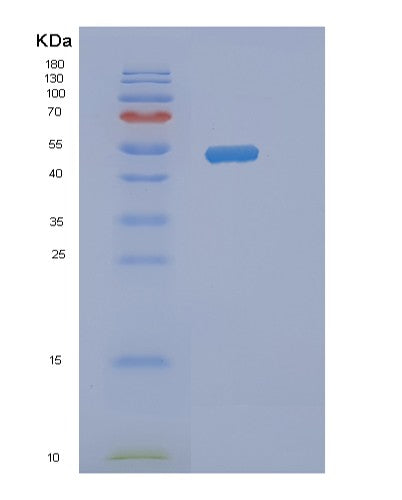 Human NAP1L4 (Nucleosome Assembly Protein 1-Like 4) - Recombinant Protein