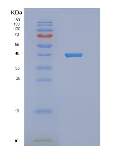 Human NDE1 (Nuclear Distribution Protein Nude Homolog 1) - Recombinant Protein