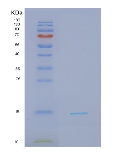 Human NDFIP1 (Nedd4 Family-Interacting Protein 1) - Recombinant Protein