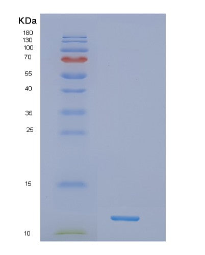 Human NDUFB4 (Nadh Dehydrogenase [Ubiquinone] 1 Beta Subcomplex Subunit 4) - Recombinant Protein