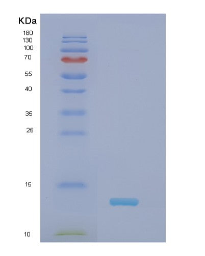 Human NDUFS6 (Nadh Dehydrogenase [Ubiquinone] Iron-Sulfur Protein 6, Mitochondrial) - Recombinant Protein