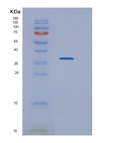 Human NEK7 (Serine/Threonine-Protein Kinase Nek7) - Recombinant Protein
