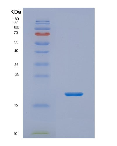 Human NHP2 (H/Aca Ribonucleoprotein Complex Subunit 2) - Recombinant Protein