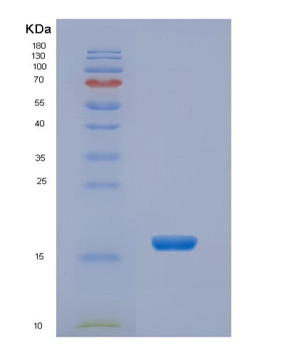Human NHP2L1 - Recombinant Protein