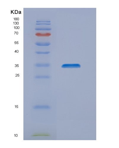 Human METTL17 (Ribosome Assembly Protein Mettl17, Mitochondrial) - Recombinant Protein
