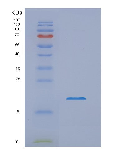 Human NME1 (Nucleoside Diphosphate Kinase A) - Recombinant Protein