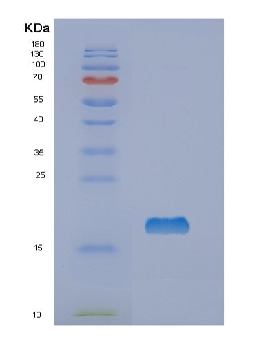 Human NME1 (Nucleoside Diphosphate Kinase A) - Recombinant Protein