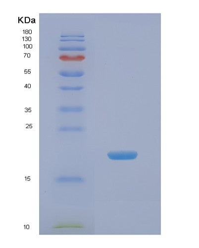 Human NME3 (Nucleoside Diphosphate Kinase 3) - Recombinant Protein