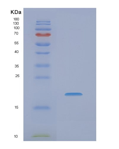Human NME4 (Nucleoside Diphosphate Kinase, Mitochondrial) - Recombinant Protein