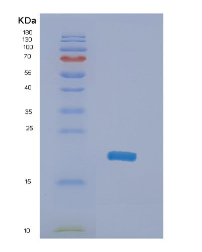 Human NME4 (Nucleoside Diphosphate Kinase, Mitochondrial) - Recombinant Protein