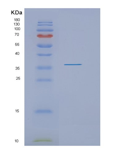 Human NMNAT1 (Nicotinamide/Nicotinic Acid Mononucleotide Adenylyltransferase 1) - Recombinant Protein