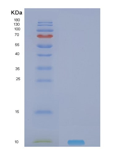 Human NRG4 (Pro-Neuregulin-4, Membrane-Bound Isoform) - Recombinant Protein