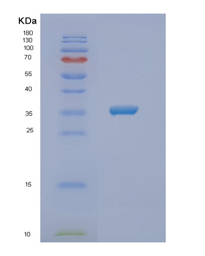 Human NSDHL (Sterol-4-Alpha-Carboxylate 3-Dehydrogenase, Decarboxylating) - Recombinant Protein