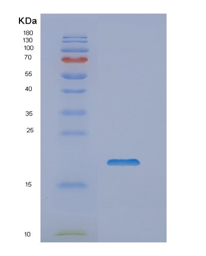 Human NUDCD2 (Nudc Domain-Containing Protein 2) - Recombinant Protein