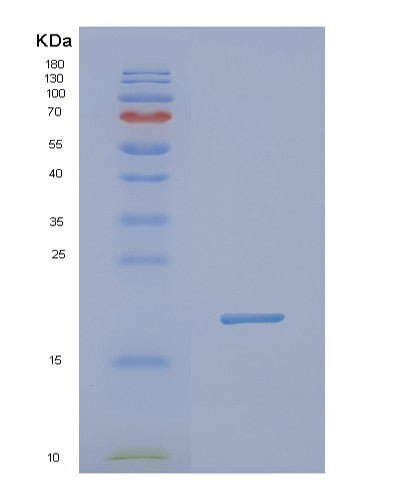 Human NXT1 (Ntf2-Related Export Protein 1) - Recombinant Protein