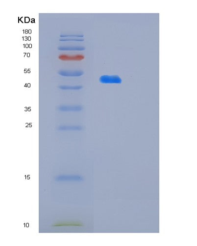 Human OLA1 (Obg-Like Atpase 1) - Recombinant Protein