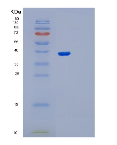Human OSGEP (Trna N6-Adenosine Threonylcarbamoyltransferase) - Recombinant Protein