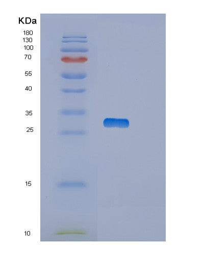 Human OTUB2 (Ubiquitin Thioesterase Otub2) - Recombinant Protein