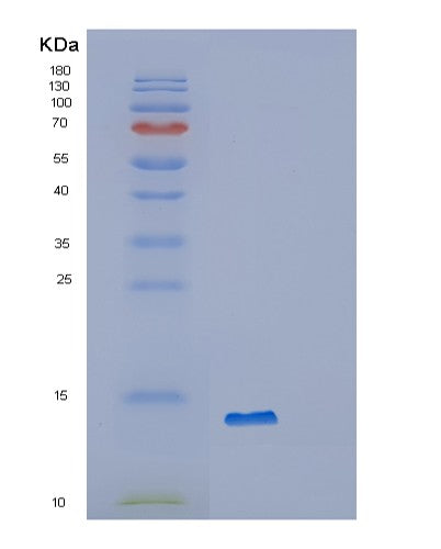 Human OXLD1 (Oxidoreductase-Like Domain-Containing Protein 1) - Recombinant Protein